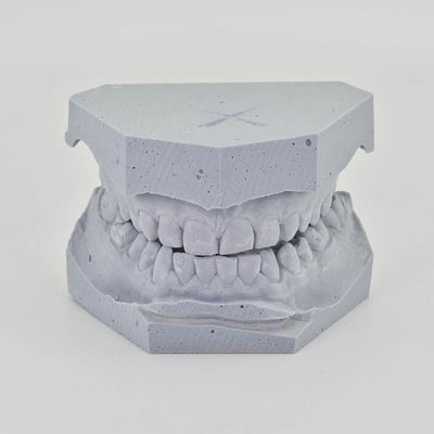 Hotové odtlačky zubov