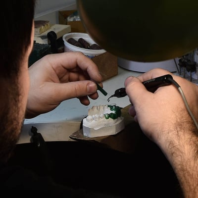 Príprava voskovej formy